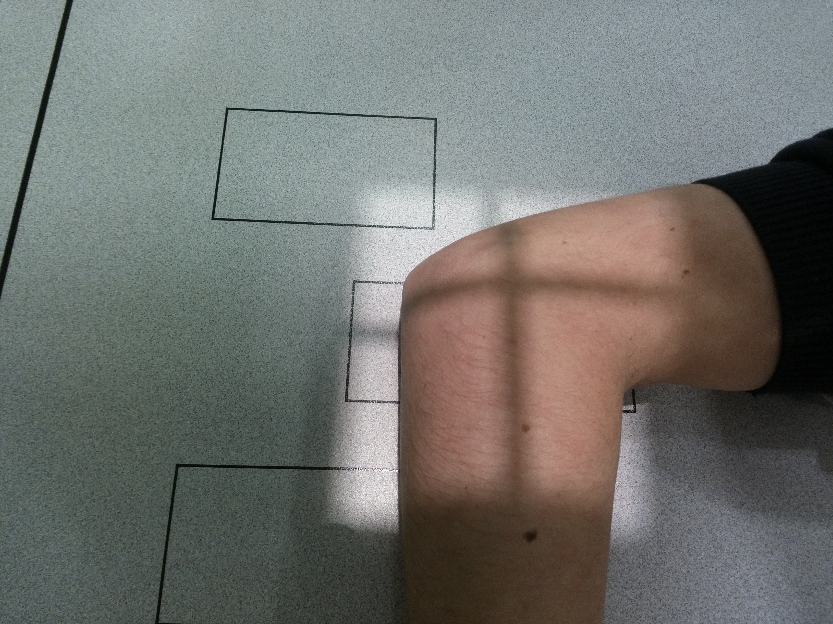 Lateral Elbow Radiograph